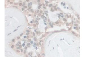 Immunohistochemistry (IHC) image for anti-Proprotein Convertase Subtilisin/kexin Type 1 (PCSK1) (AA 500-738) antibody (ABIN7435748)