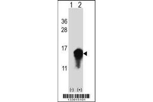 Western blot analysis of CSTA using rabbit polyclonal CSTA Antibody using 293 cell lysates (2 ug/lane) either nontransfected (Lane 1) or transiently transfected (Lane 2) with the CSTA gene. (CSTA 抗体  (C-Term))
