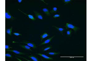 Immunofluorescence of monoclonal antibody to USP47 on HeLa cell. (USP47 抗体  (AA 203-301))