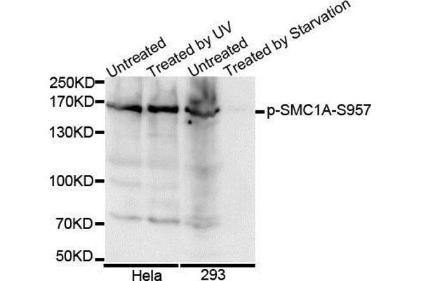 SMC1A 抗体  (pSer957)
