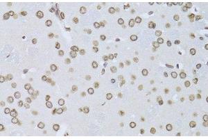 Immunohistochemistry of paraffin-embedded Mouse brain using LMNB2 Polyclonal Antibody at dilution of 1:100 (40x lens).
