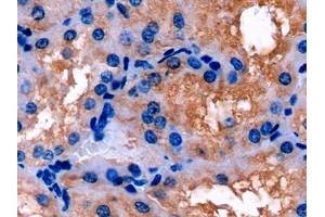 Detection of APOE in Porcine Kidney Tissue using Polyclonal Antibody to Apolipoprotein E (APOE) (APOE 抗体  (AA 16-175))