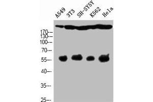 Western Blot analysis of A549 NIH-3T3 SH-SY5Y K562 HELA cells using Cleaved-Notch 4 (V1432) Polyclonal Antibody (NOTCH4 抗体  (Cleaved-Val1432))