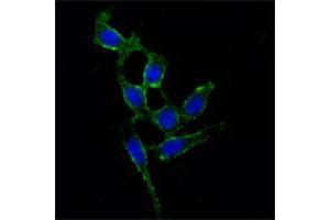Immunofluorescence analysis of A549 cells using FAK mouse mAb (green). (FAK 抗体)