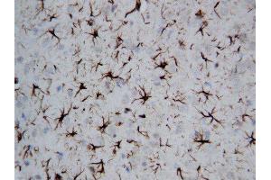 Anti-GFAP antibody, IHC(P) IHC(P): Rat Brain Tissue (GFAP 抗体  (C-Term))