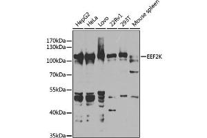 Western blot analysis of extracts of various cell lines, using EEF2K antibody (ABIN6130354, ABIN6139955, ABIN6139956 and ABIN7101771) at 1:1000 dilution. (EEF2K 抗体  (AA 406-725))