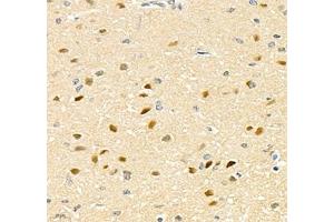 Immunohistochemistry of paraffin embedded rat brain using TCEAL3 (ABIN7075951) at dilution of 1:700 (400x lens) (TCEAL3 抗体)