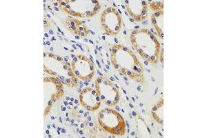 Immunohistochemical analysis of paraffin-embedded H. (PGK1 抗体  (AA 117-145))