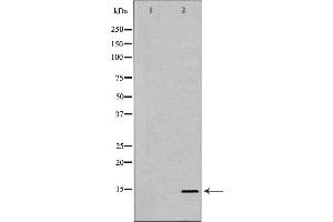 Western blot analysis of A549 whole cell lysates, using PHPT1 Antibody. (PHPT1 抗体  (Internal Region))