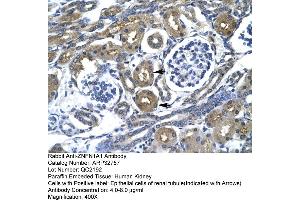 Human kidney (IKZF1 抗体  (Middle Region))