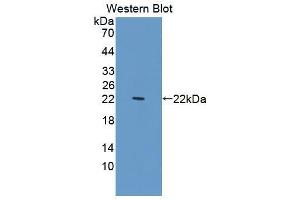 Western blot analysis of recombinant Human PDCD6. (PDCD6 抗体  (AA 32-191))