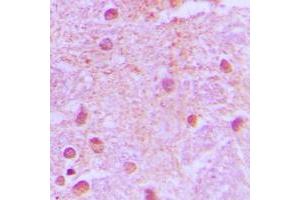 Immunohistochemical analysis of TLE4 staining in human brain formalin fixed paraffin embedded tissue section. (TLE4 抗体  (Center))