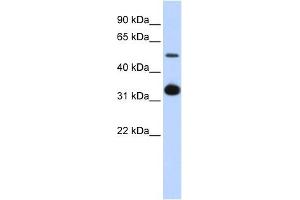 GDF2 antibody used at 1 ug/ml to detect target protein. (GDF2 抗体  (Middle Region))