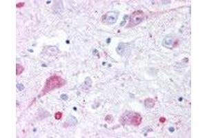 Human Brain, Thalamus (formalin-fixed, paraffin-embedded) stained with GRM2 antibody ABIN213522 at 4 ug/ml followed by biotinylated goat anti-rabbit IgG secondary antibody ABIN481713, alkaline phosphatase-streptavidin and chromogen. (GRM2 抗体  (N-Term))