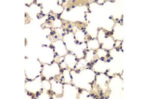Immunohistochemistry of paraffin-embedded mouse lung using CXXC1 antibody (ABIN5973429) at dilution of 1/200 (40x lens). (CXXC1 抗体)
