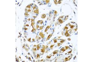 Immunohistochemistry of paraffin-embedded human stomach using PIAS3 antibody (ABIN5974247) at dilution of 1/100 (40x lens). (PIAS3 抗体)