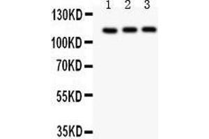 Western Blotting (WB) image for anti-Transient Receptor Potential Cation Channel, Subfamily C, Member 5 (TRPC5) (AA 684-973) antibody (ABIN3043493)