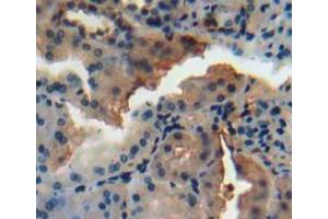 Used in DAB staining on fromalin fixed paraffin-embedded kidney tissue (N-Acetyl alpha-D-Glucosaminidase (AA 485-743) 抗体)