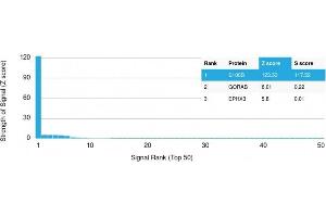 Analysis of Protein Array containing more than 19,000 full-length human proteins using S100B Mouse Monoclonal Antibody (S100B/1012) Z- and S- Score: The Z-score represents the strength of a signal that a monoclonal antibody (MAb) (in combination with a fluorescently-tagged anti-IgG secondary antibody) produces when binding to a particular protein on the HuProtTM array. (S100B 抗体)