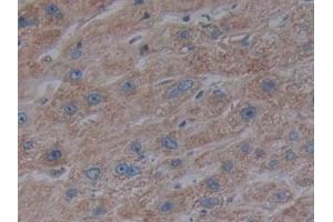 Immunohistochemistry (IHC) image for anti-CD40 (CD40) (AA 26-187) antibody (ABIN7442747)