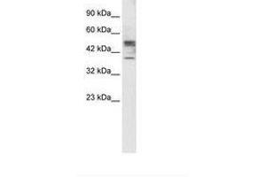Image no. 2 for anti-Carbohydrate (N-Acetylglucosamine 6-O) Sulfotransferase 4 (CHST4) (AA 156-205) antibody (ABIN202397) (CHST4 抗体  (AA 156-205))