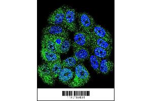Confocal immunofluorescent analysis of ABL1 Antibody with MCF-7 cell followed by Alexa Fluor 488-conjugated goat anti-rabbit lgG (green). (ABL1 抗体  (AA 741-769))