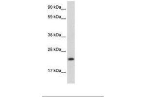 Image no. 2 for anti-Achaete-Scute Complex Homolog 1 (Drosophila) (ASCL1) (AA 48-97) antibody (ABIN202101)