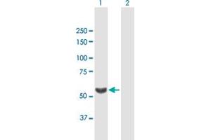 Western Blot analysis of TBL1X expression in transfected 293T cell line by TBL1X MaxPab polyclonal antibody. (TBL1X 抗体  (AA 1-526))