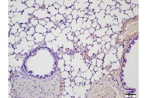 Paraformaldehyde-fixed, paraffin embedded Mouse lung, Antigen retrieval by boiling in sodium citrate buffer (pH6. (MMP2 抗体  (AA 31-109))