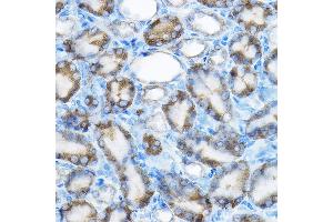 Immunohistochemistry of paraffin-embedded rat kidney using MRPL13 Rabbit pAb  at dilution of 1:100 (40x lens). (MRPL13 抗体  (AA 1-179))