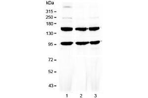 Western blot testing of human 1) HeLa, 2) MCF7 and 3) HepG2 cell lysate with VEGFR3 antibody at 0.