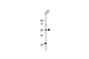 All lanes : Anti-CYP27B1 Antibody (C-term) at 1:500 dilution Lane 1: T47D whole cell lysate Lysates/proteins at 20 μg per lane. (CYP27B1 抗体  (C-Term))