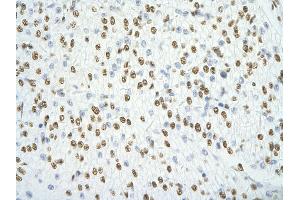 Rabbit Anti-SFPQ antibody   Paraffin Embedded Tissue: Human Heart cell Cellular Data: cardiac cell of renal tubule Antibody Concentration: 4.
