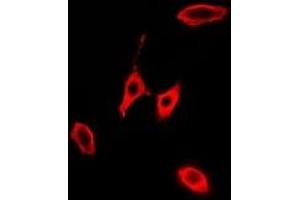 Immunofluorescent analysis of KLK10 staining in A549 cells. (Kallikrein 10 抗体)