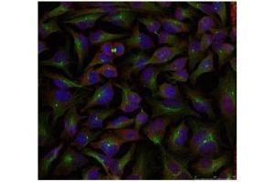 Image no. 1 for anti-Stathmin 1 (STMN1) (Ser24) antibody (ABIN197454) (Stathmin 1 抗体  (Ser24))