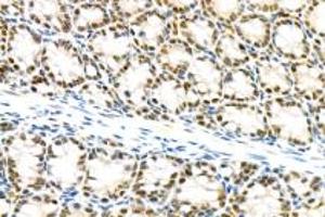 Immunohistochemistry analysis of paraffin-embedded mouse colon using mSin3A (ABIN7075609) at dilution of 1: 100 (SIN3A 抗体)
