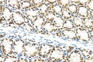 Immunohistochemistry analysis of paraffin-embedded mouse colon using mSin3A (ABIN7075609) at dilution of 1: 100