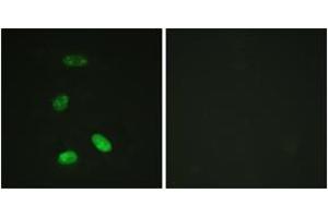 Immunofluorescence analysis of HeLa cells, using MYB (Ab-12) Antibody. (MYB 抗体  (AA 1-50))