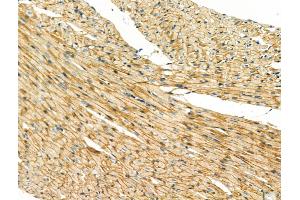 ABIN6260635 and ABIN6268671 at 1/100 staining Rat heart tissue by IHC-P.