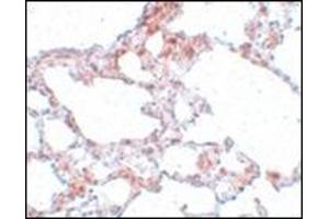 Immunohistochemistry of MRE11 in rat lung tissue with MRE11 antibody at 5 μg/ml. (Mre11 抗体  (N-Term))