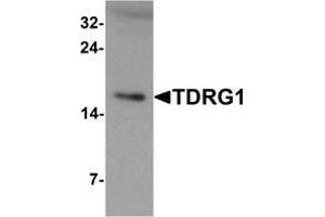 Western blot analysis of TDRG1 in human testis tissue lysate with TDRG1 Antibody  at 1 μg/ml (TDRG1 抗体  (Middle Region))