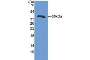 Detection of Recombinant SIRT4, Mouse using Polyclonal Antibody to Sirtuin 4 (SIRT4)