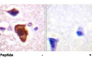 Immunohistochemical analysis of paraffin-embedded human brain tissue using C5AR1 polyclonal antibody . (C5AR1 抗体)