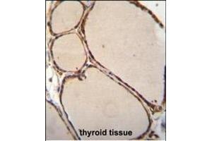 NFKBID Antibody (N-term) (ABIN655836 and ABIN2845251) immunohistochemistry analysis in formalin fixed and paraffin embedded human thyroid tissue followed by peroxidase conjugation of the secondary antibody and DAB staining. (NFKBID 抗体  (N-Term))