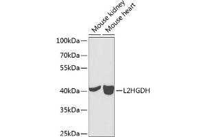 Western blot analysis of extracts of various cell lines, using L2HGDH antibody (ABIN6132151, ABIN6143055, ABIN6143056 and ABIN6224014) at 1:1000 dilution. (L2HGDH 抗体  (AA 1-220))