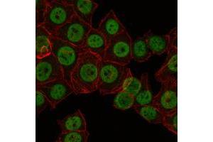 Immunofluorescence analysis of NTERA-2 cells using CRTC3 mouse mAb (green).