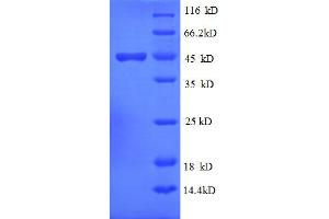 ISG15 Ubiquitin-Like Modifier (ISG15) (AA 2-157), (full length) protein (GST tag) (ISG15 Protein (AA 2-157, full length) (GST tag))