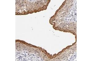 Immunohistochemical staining of human urinary bladder with C14orf135 polyclonal antibody  shows strong cytoplasmic positivity in urothelial cells at 1:20-1:50 dilution. (PCNXL4 抗体)