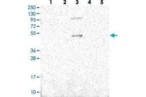 Western blot analysis of Lane 1: RT-4, Lane 2: U-251 MG, Lane 3: Human Plasma, Lane 4: Liver, Lane 5: Tonsil with SLC10A5 polyclonal antibody . (SLC10A5 抗体)