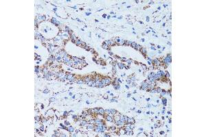 Immunohistochemistry of paraffin-embedded human colon carcinoma using GIP antibody (ABIN1882357) at dilution of 1:100 (40x lens). (GIP 抗体)